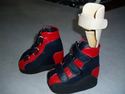 内反尖足のお子さまに作製した靴（ブーツ）とシーネ
