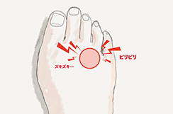 その足の痛みやシビれ、モートン病が原因かも？！ 〜 原因と対策 〜