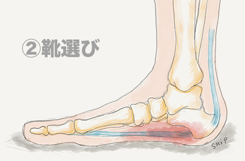 【足底腱膜炎② 靴選び】足底腱膜炎を悪化させにくい靴とは？ 靴選びのポイントを解説