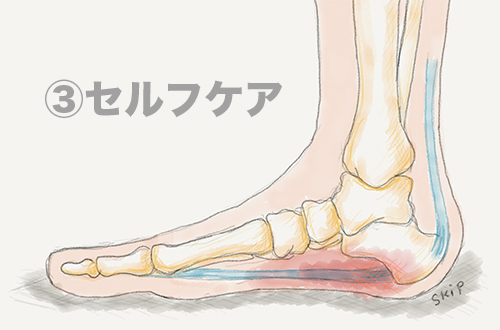 【足底腱膜炎③ セルフケア】足底腱膜炎をやわらげるセルフケア｜ストレッチと日常で気をつけたいこと
